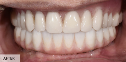 After Image