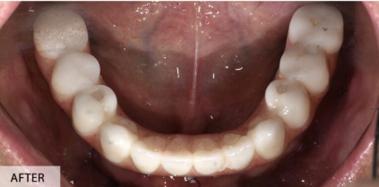 After Image