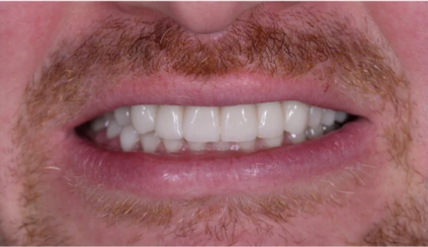 After Image