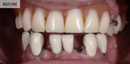 Before Image
