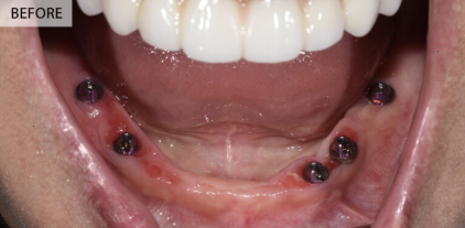 Before Image