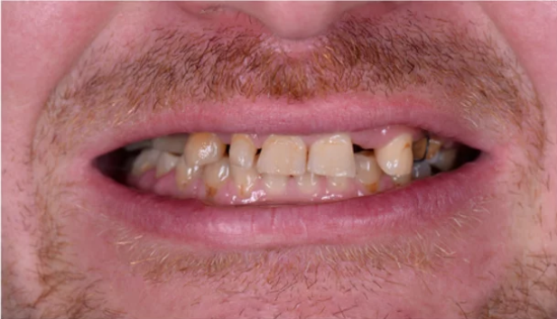 Before Image